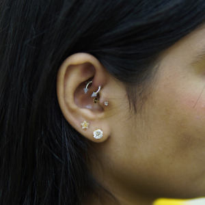 What Is Piercing Migration and How to Prevent It