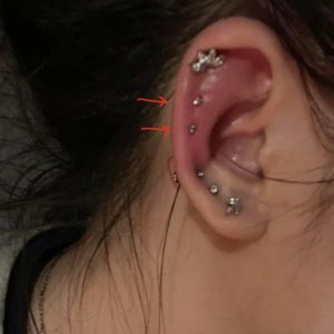 Piercing Swelling? Here’s How to Calm It Quickly